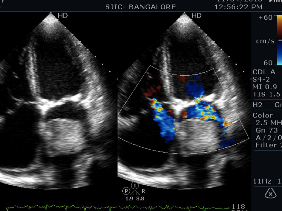 Figure 3. 