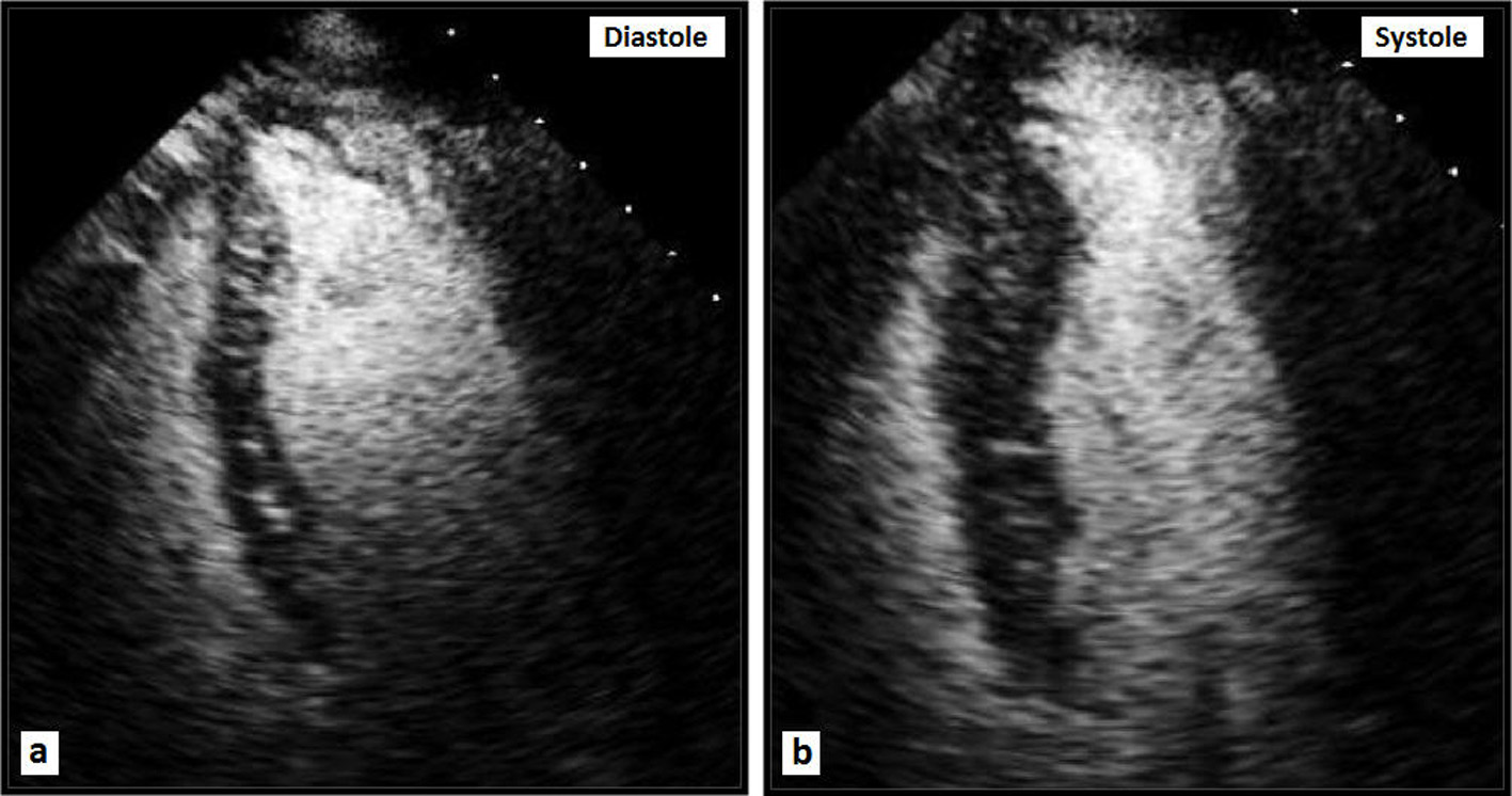 Cardiol Res