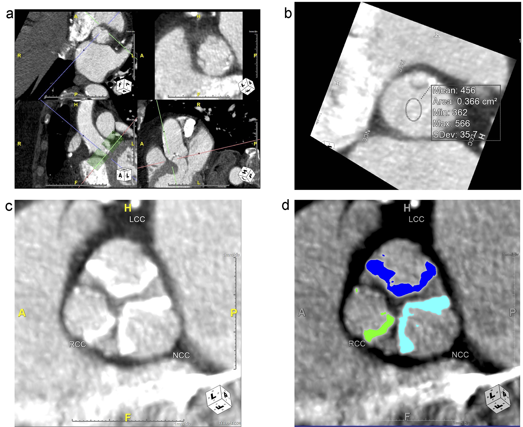 Figure 3. 