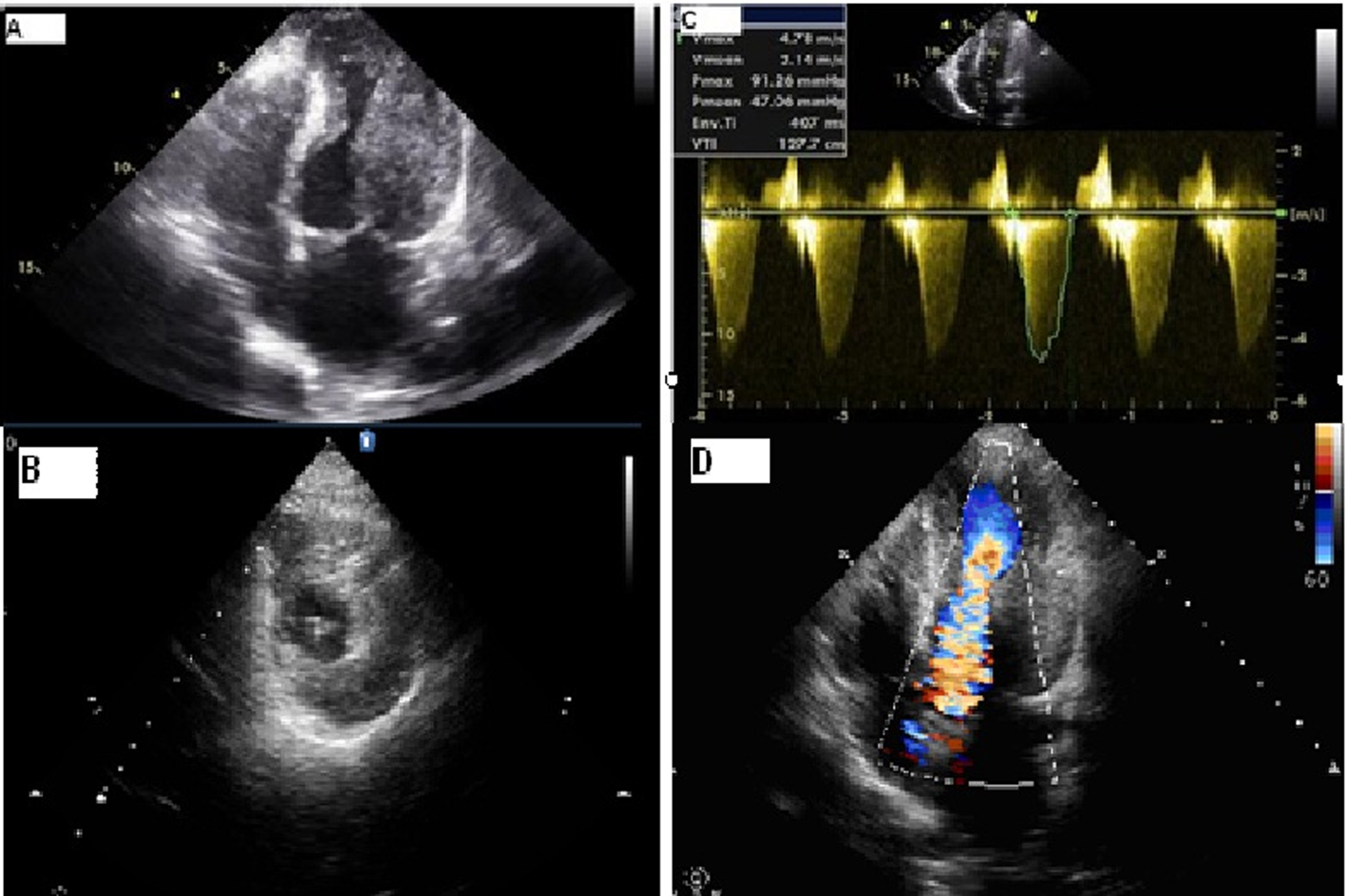 Figure 2. 