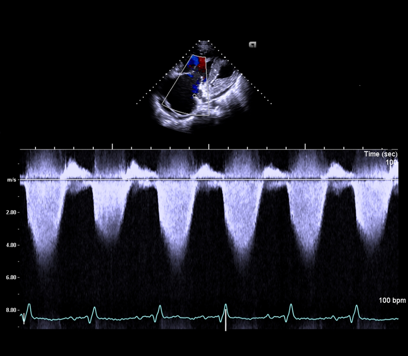 Figure 3. 