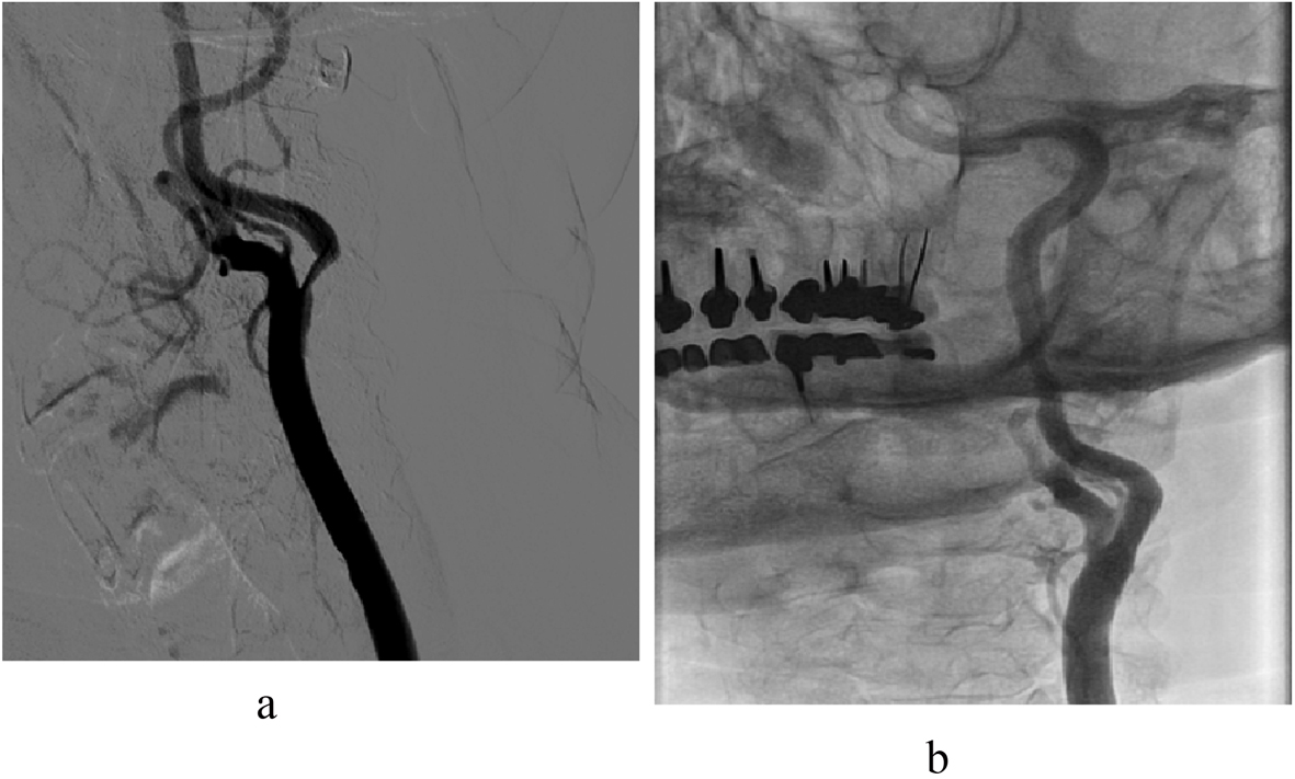 Figure 6. 