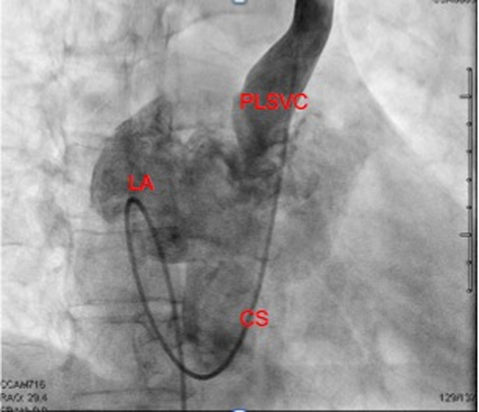 Figure 4. 