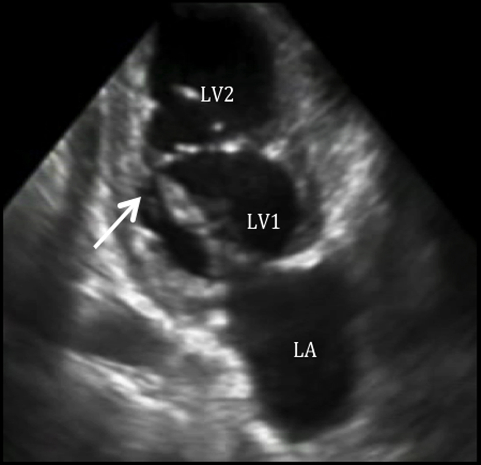 Figure 2. 