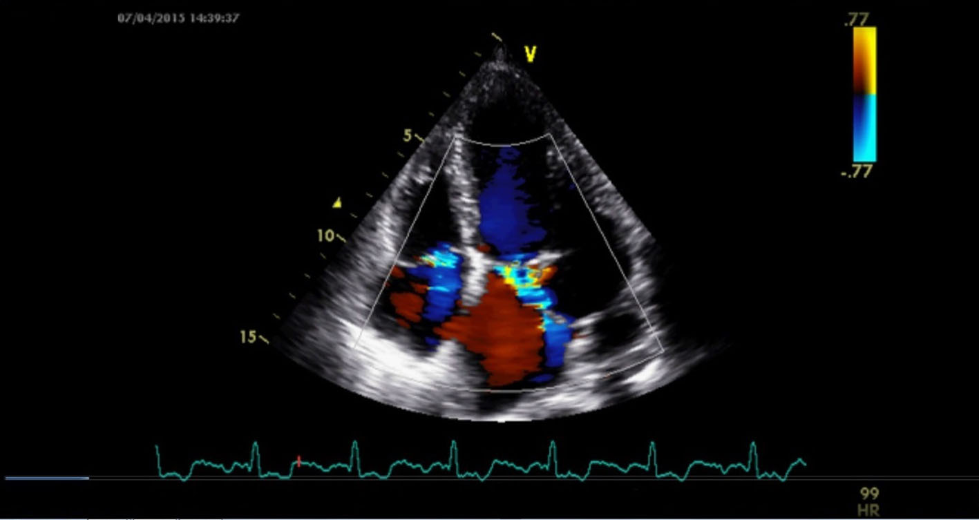 Figure 2. 