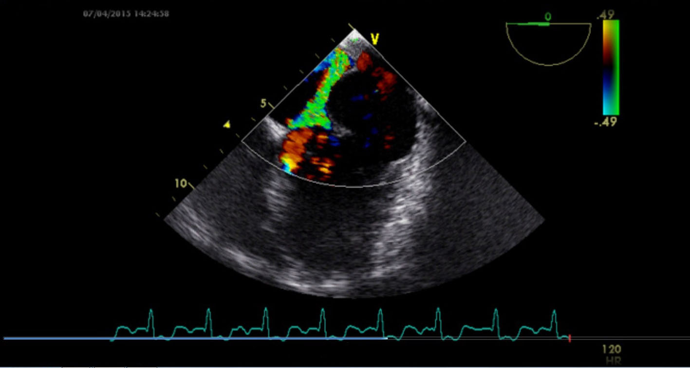 Figure 4. 