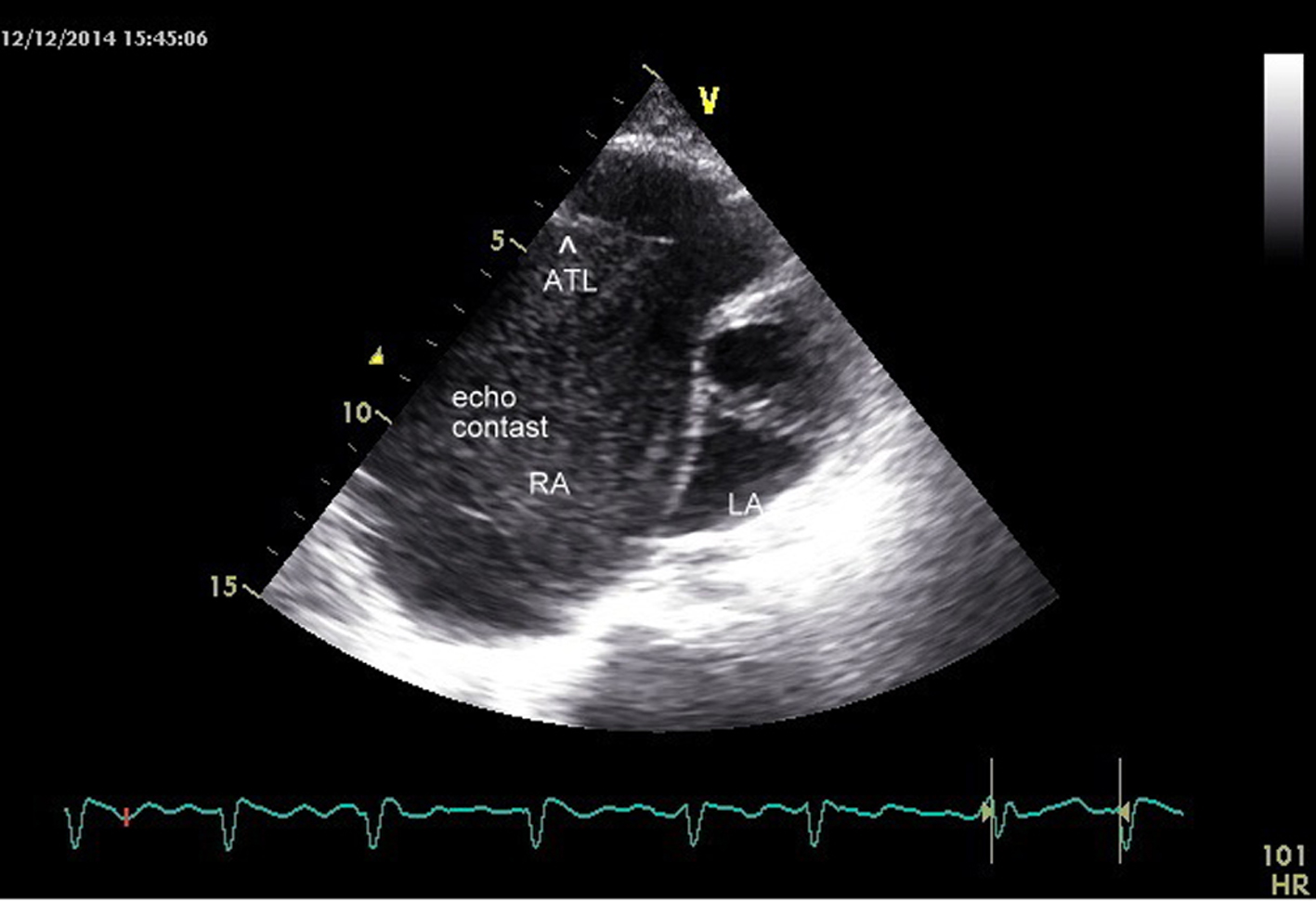 Figure 3. 