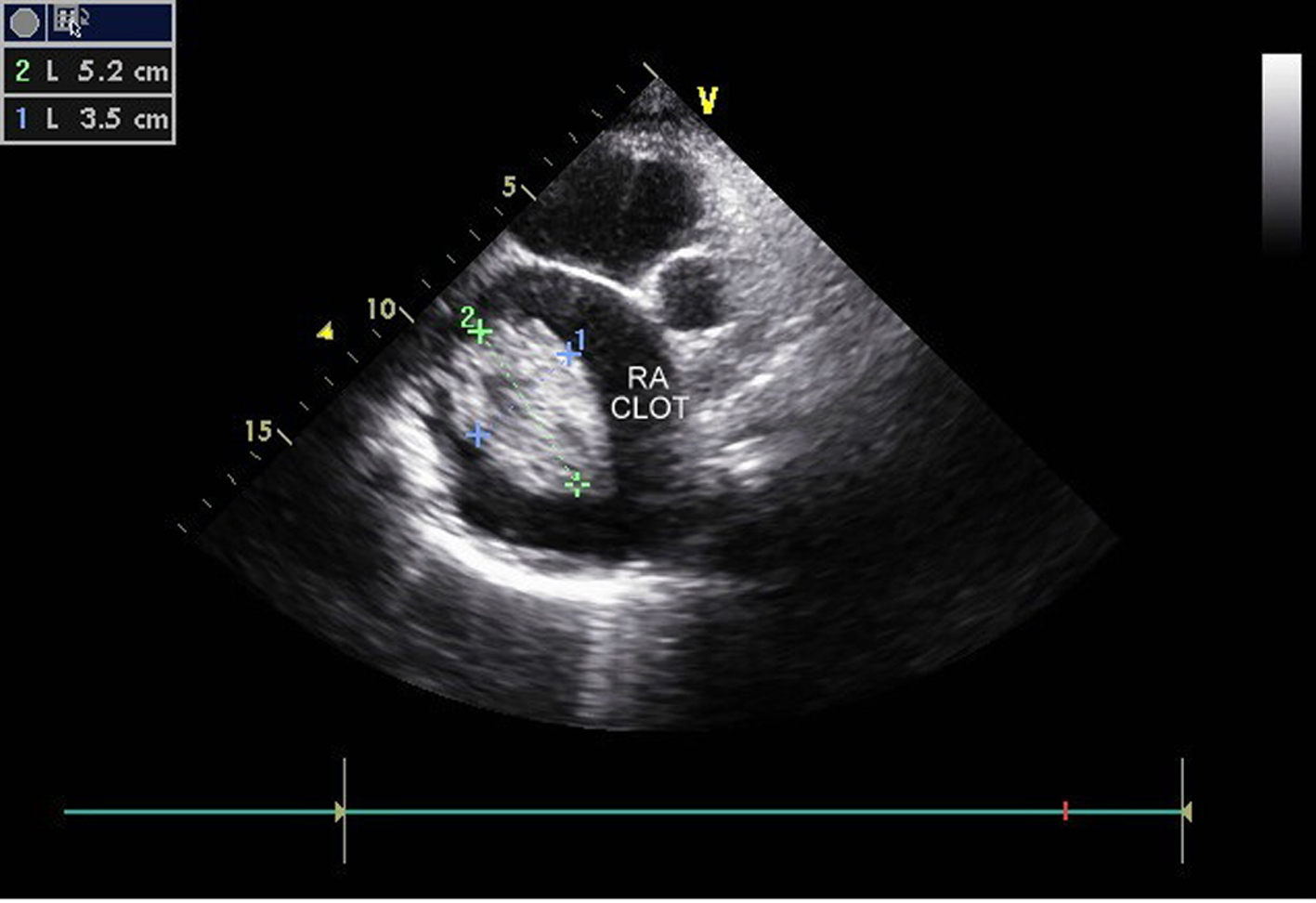 Cardiol Res