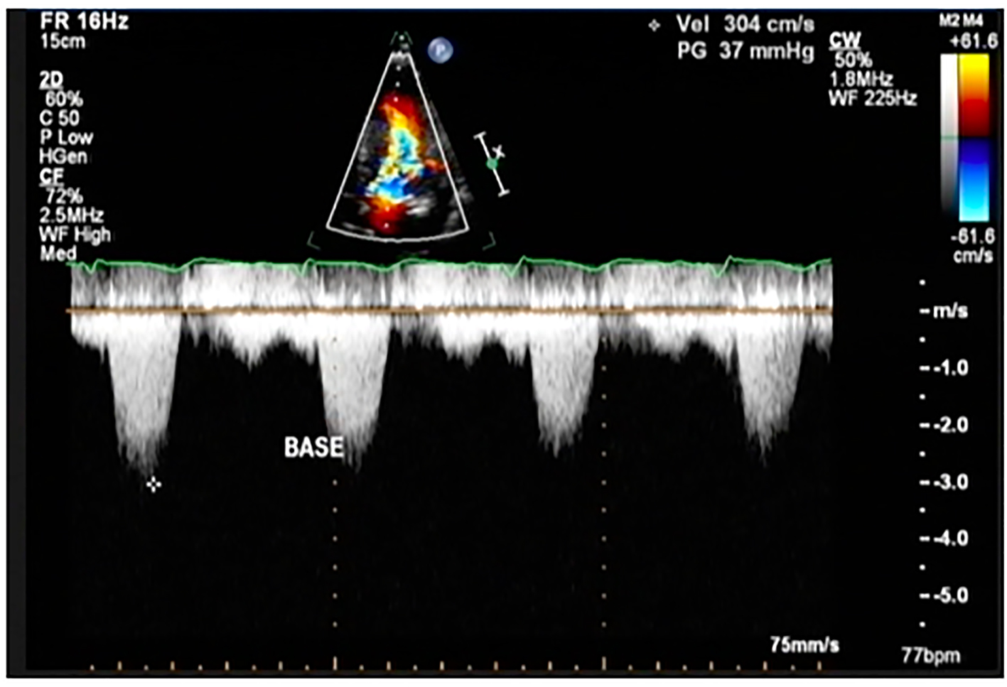 Figure 6. 