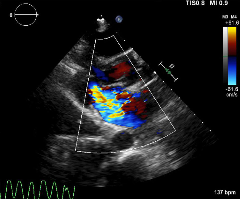 Figure 3. 