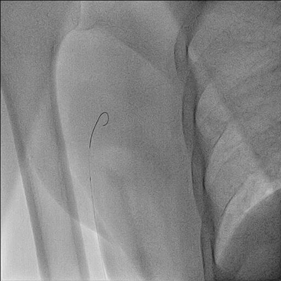 Figure 3. 