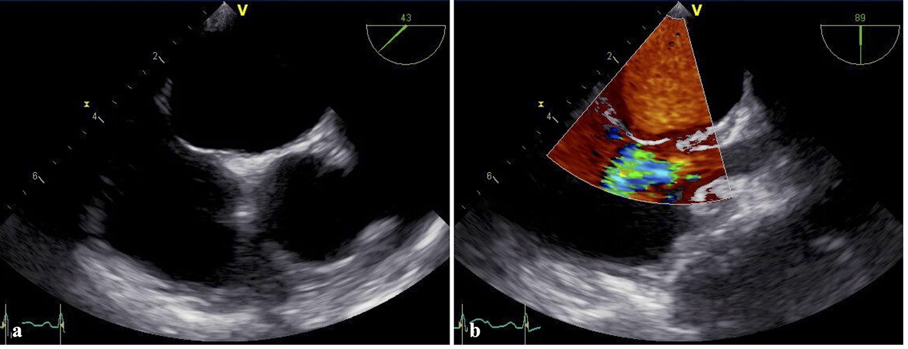 Figure 3. 