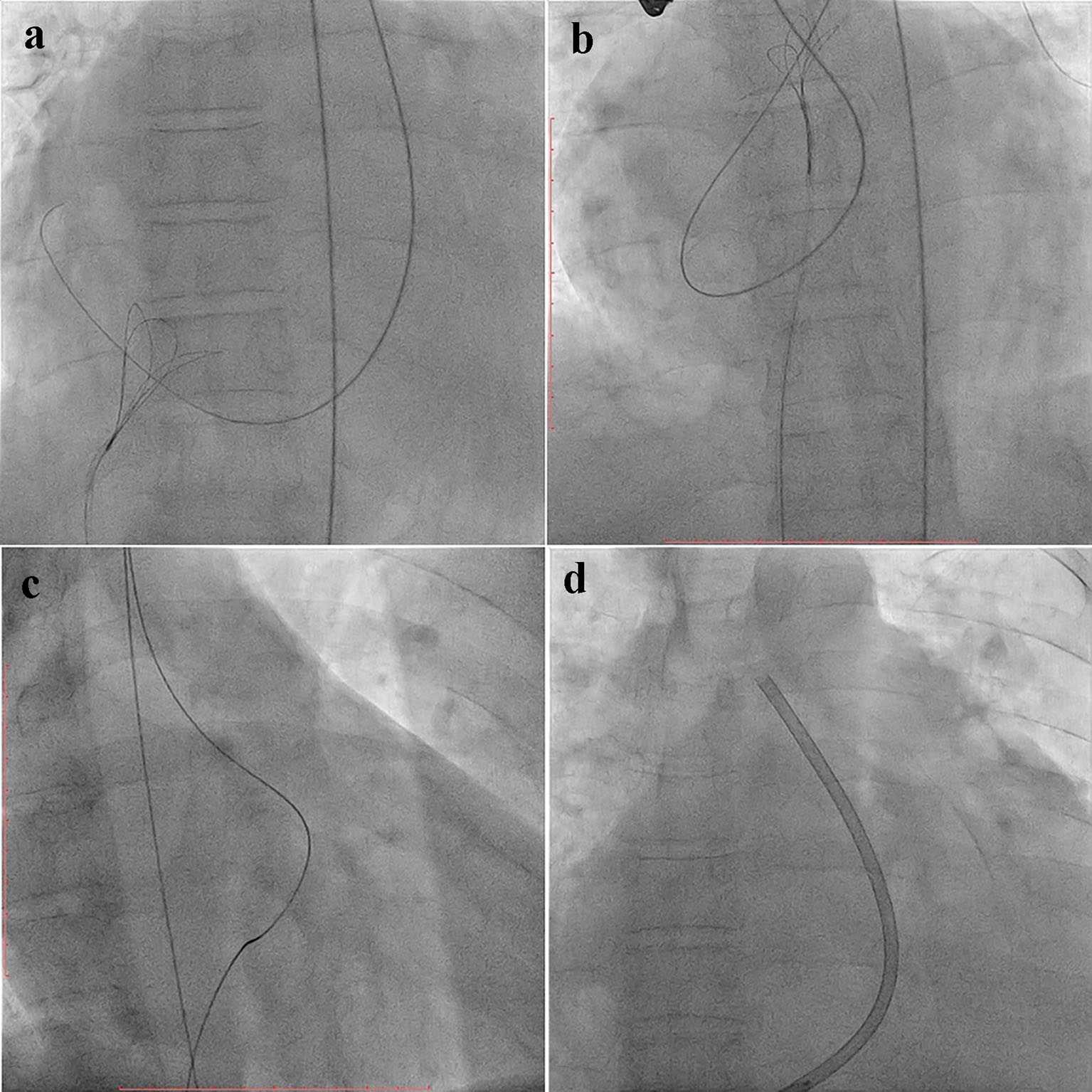 Figure 3. 