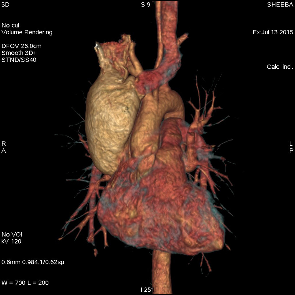 Figure 3. 