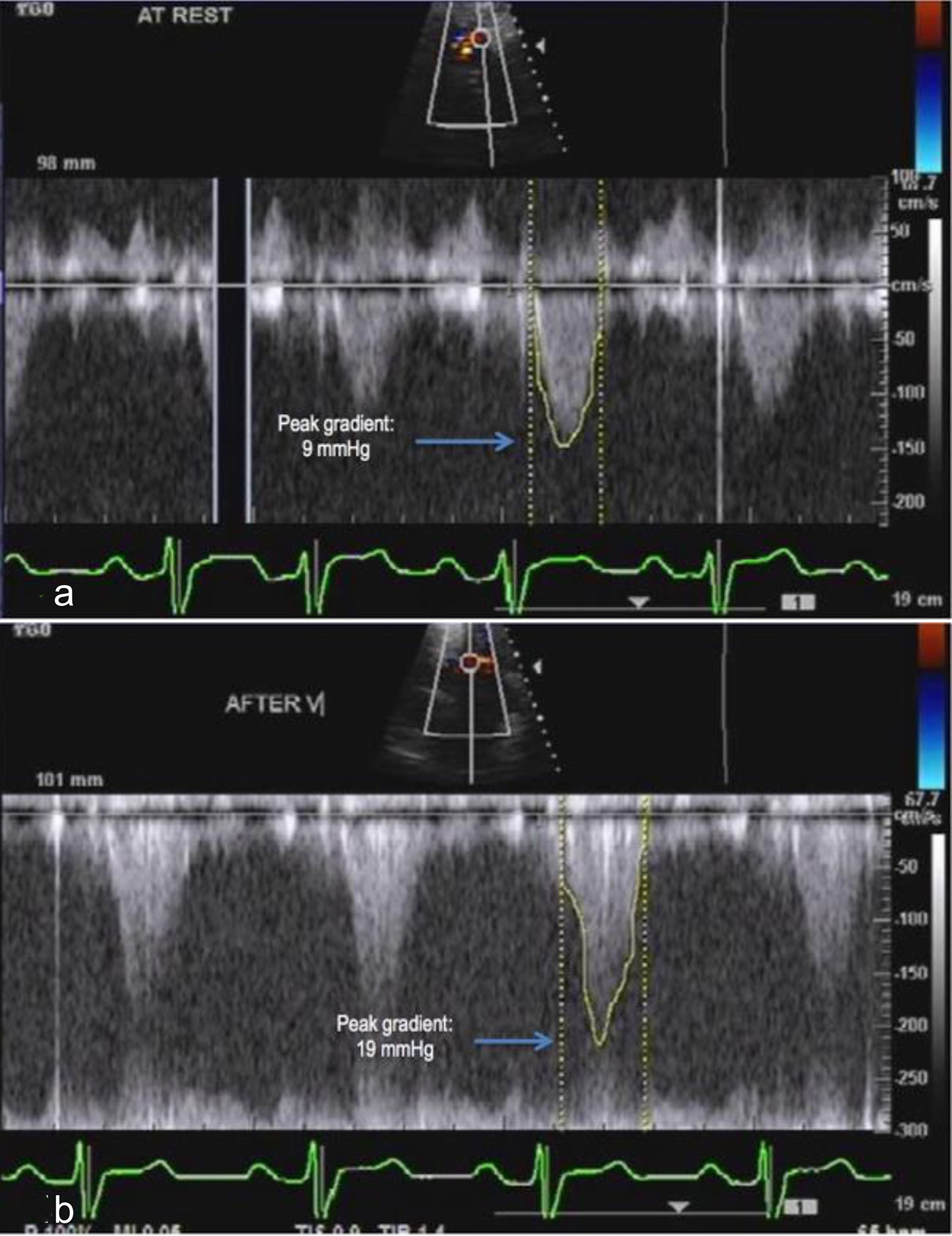 Figure 4. 