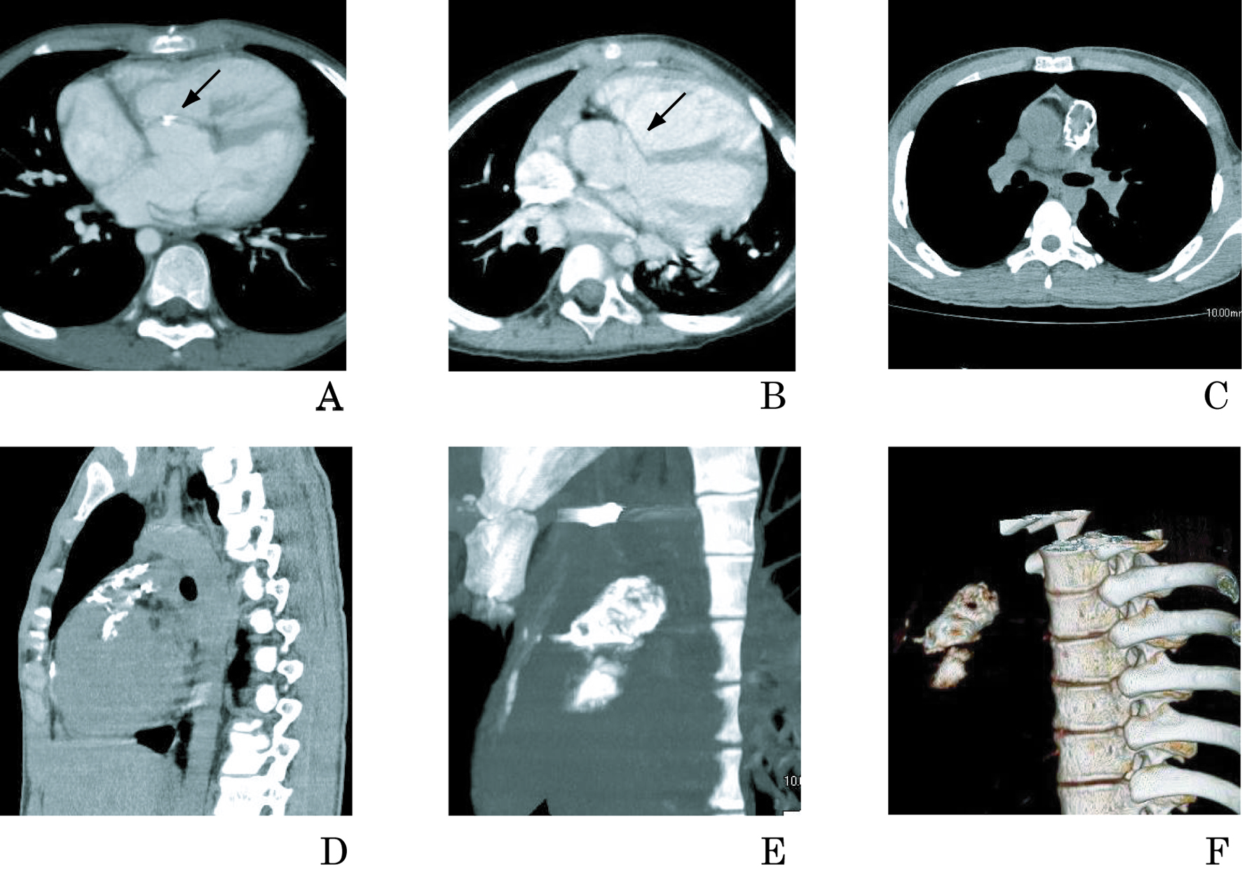 Figure 4. 