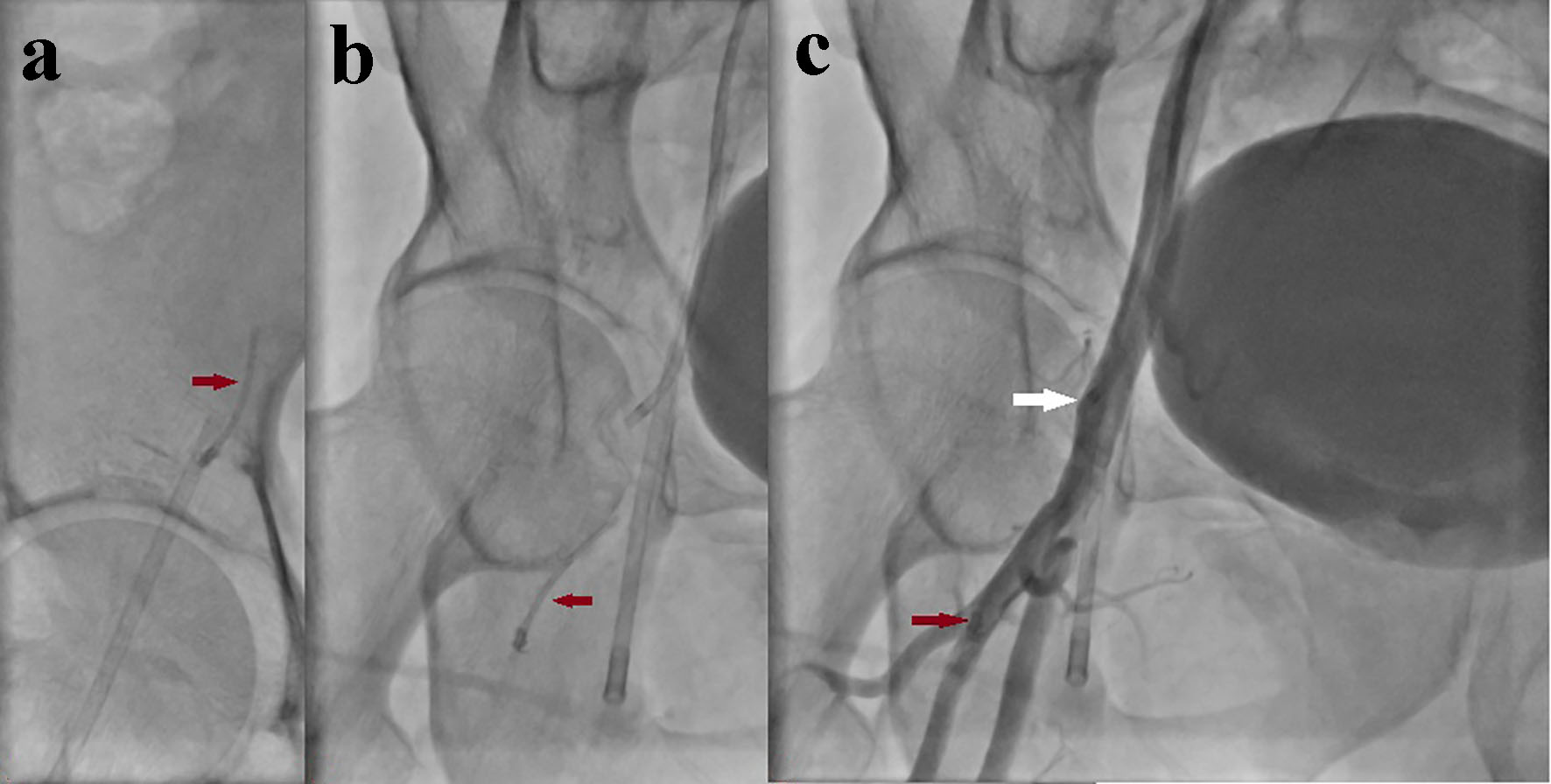 Figure 4. 