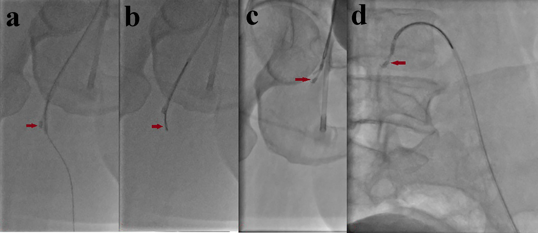 Figure 5. 