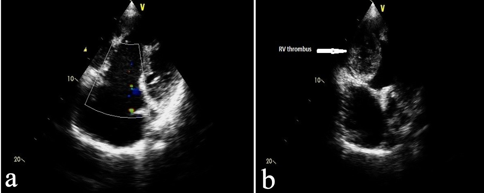 Figure 4. 