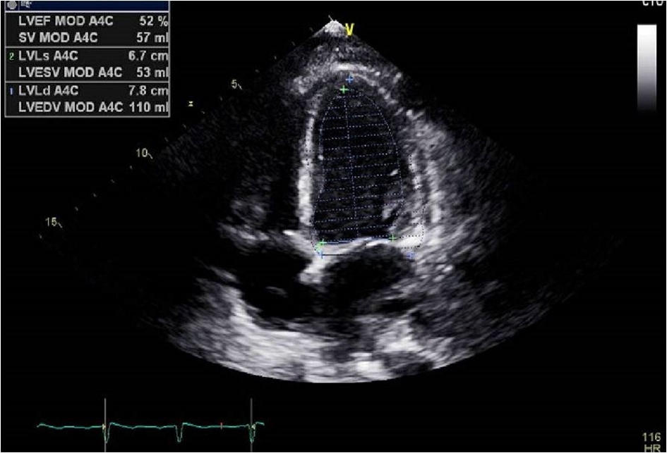 Figure 3. 