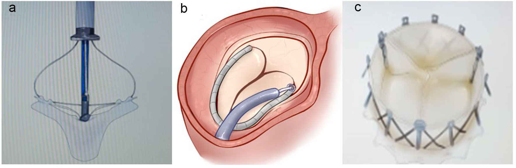 Figure 4. 