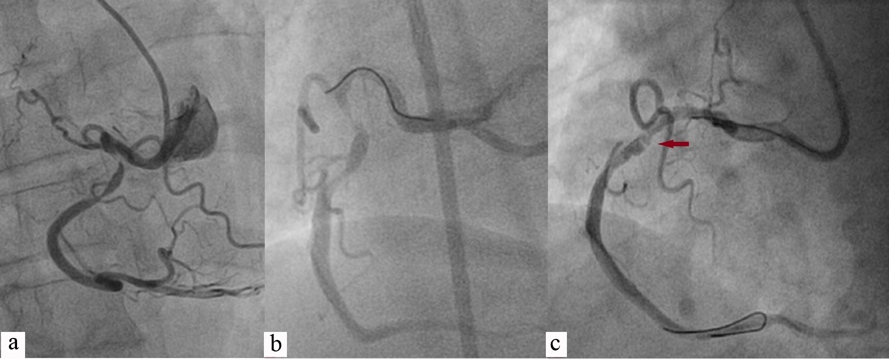 Figure 2. 