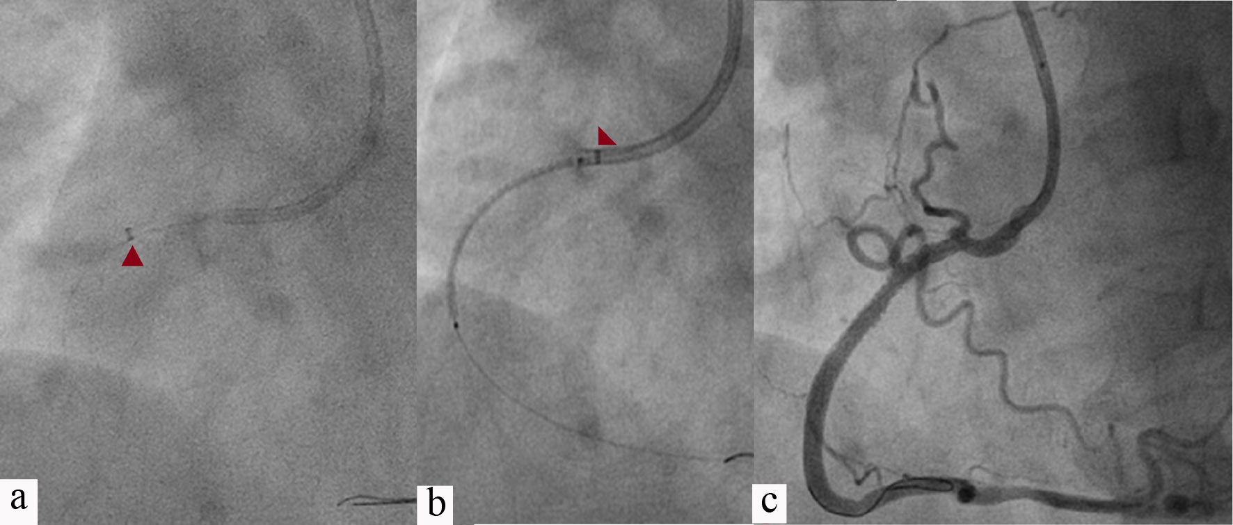 Figure 3. 