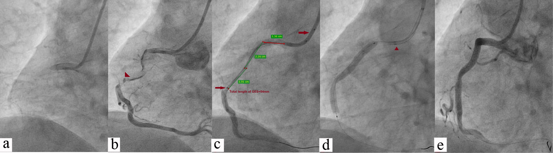 Figure 4. 